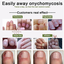 Load image into Gallery viewer, Nail Reviver